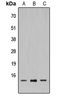 SH2D1A Antibody