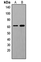 SHCA (Phospho-Y349) Antibody