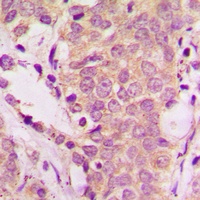 SHCA (Phospho-Y349) Antibody