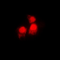 SIAH2 antibody