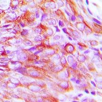 Anti-SMIT1 Antibody