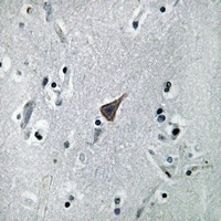 Anti-SLC6A16 Antibody