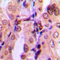 Anti-SMAD2 (Phospho-S465) Antibody