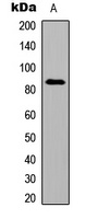Smoothened Rabbit Polyclonal Antibody
