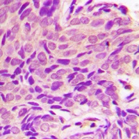 Smoothened Rabbit Polyclonal Antibody