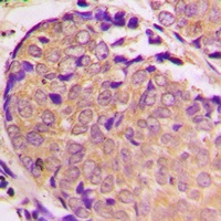 Anti-Alpha-synuclein (Phospho-S129) Antibody