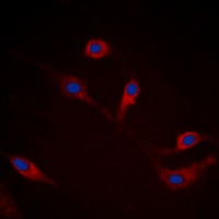 Anti-Alpha-synuclein (Phospho-S129) Antibody