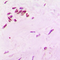 Anti-SOX6 Antibody