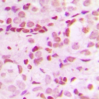 Anti-SP1 (Phospho-T453) Antibody