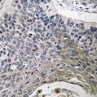 Anti-SPINK6 Antibody