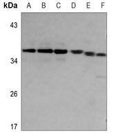 SRA Rabbit Polyclonal Antibody