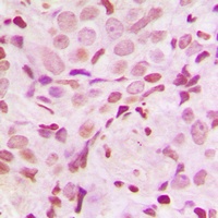 Anti-SRF (Phospho-S103) Antibody