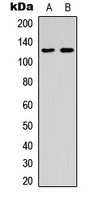 ST5 Rabbit Polyclonal Antibody