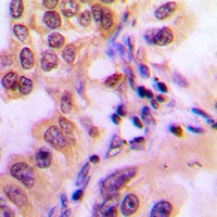 Anti-STAT2 (Phospho-Y690) Antibody