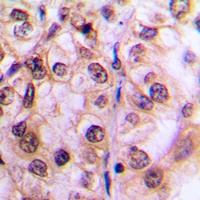 Anti-MST1/2 (Phospho-T183) Antibody