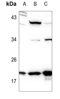 STMN1 Antibody