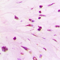 Anti-SUPT3H Antibody