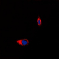 Anti-Tachykinin Receptor 1 Antibody
