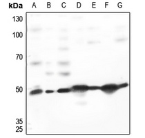 TACSTD2 Antibody