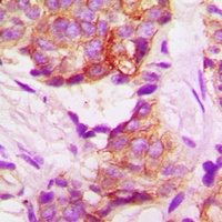 TACSTD2 Antibody