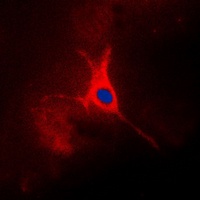 TACSTD2 Antibody