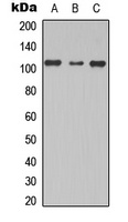 TBC1D2 Rabbit Polyclonal Antibody