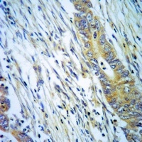 Anti-TBC1D2 Antibody