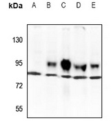 TBX3 Rabbit Polyclonal Antibody