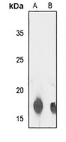 TCEAL8 Antibody