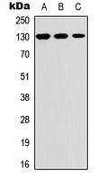 Thrombospondin 2 Antibody
