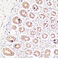 Thrombospondin 2 Antibody