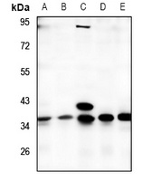 TMBIM1 Antibody