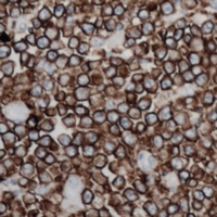 Anti-CD254 Antibody