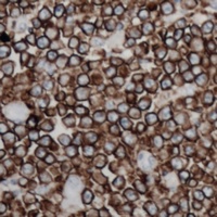 CD254 antibody