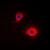 Anti-CD254 Antibody