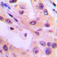 Anti-ACK1 (Phospho-Y284) Antibody
