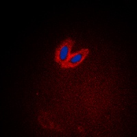 Anti-ACK1 (Phospho-Y284) Antibody