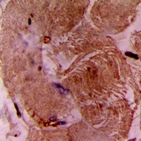 Anti-cTnI Antibody