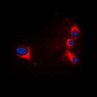 Anti-cTnI Antibody