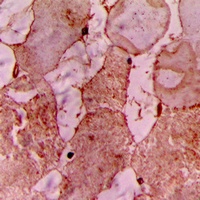 Anti-CARK Antibody