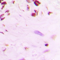p53 (phospho-S392) antibody