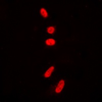 p53 (AcK381) antibody