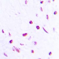 Anti-p63 (Phospho-S455) Antibody