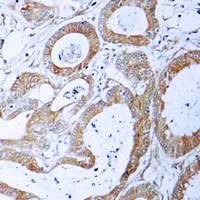 Anti-TRADD Antibody