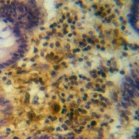 Anti-TRIM38 Antibody