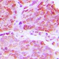TTF1 Rabbit Polyclonal Antibody