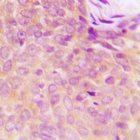 Anti-UBA5 Antibody