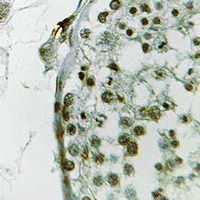 Anti-Ubiquilin 3 Antibody