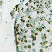 Ubiquilin 3 antibody