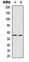 Vimentin Rabbit Polyclonal Antibody